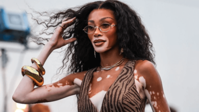 Winnie Harlow Net Worth