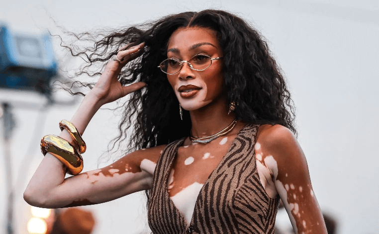 Winnie Harlow Net Worth