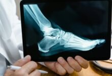 mobile call analysis report