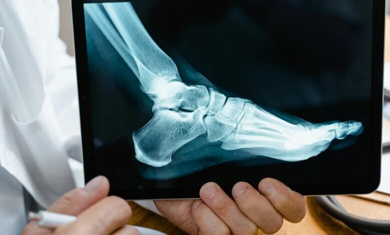 mobile call analysis report